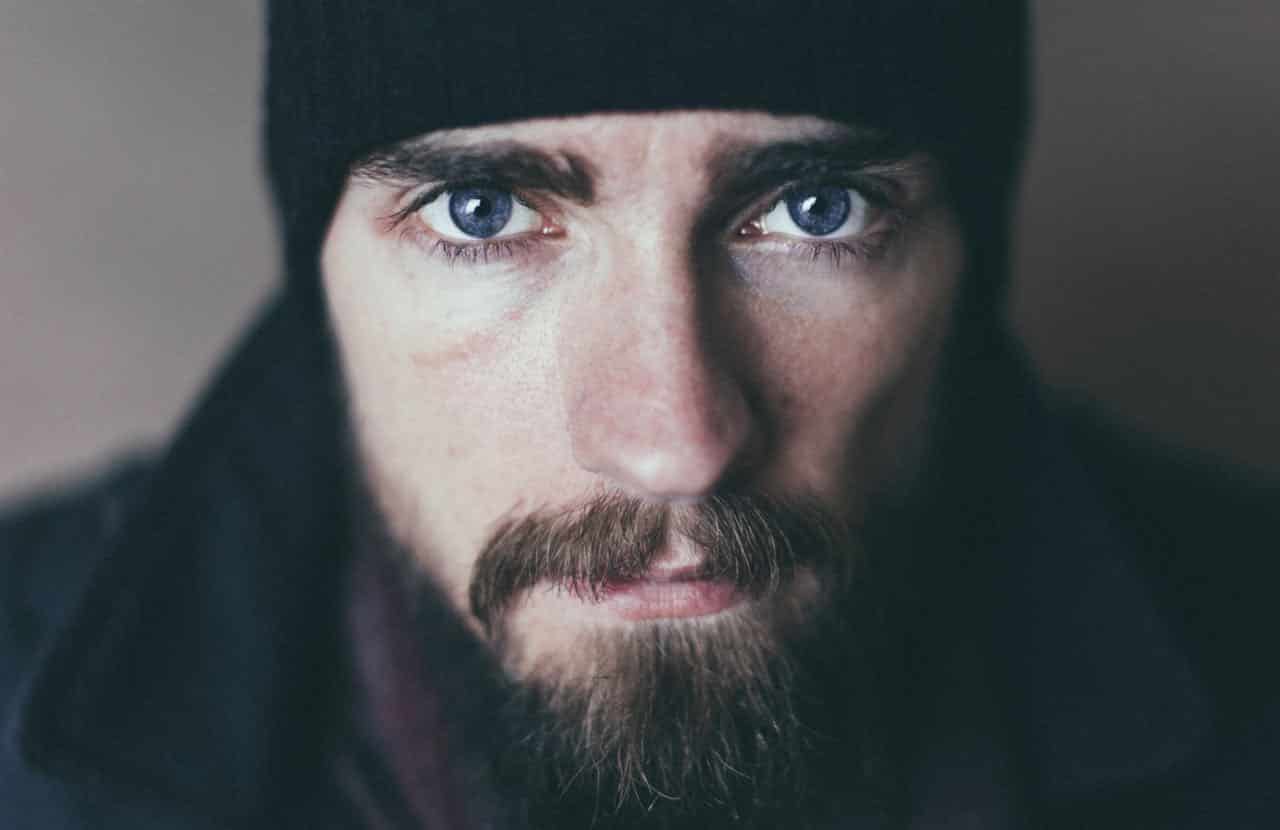 Beard Transplant