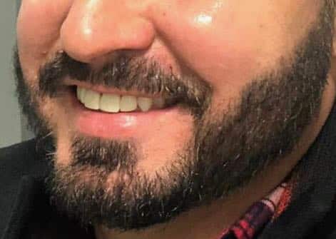 beard after