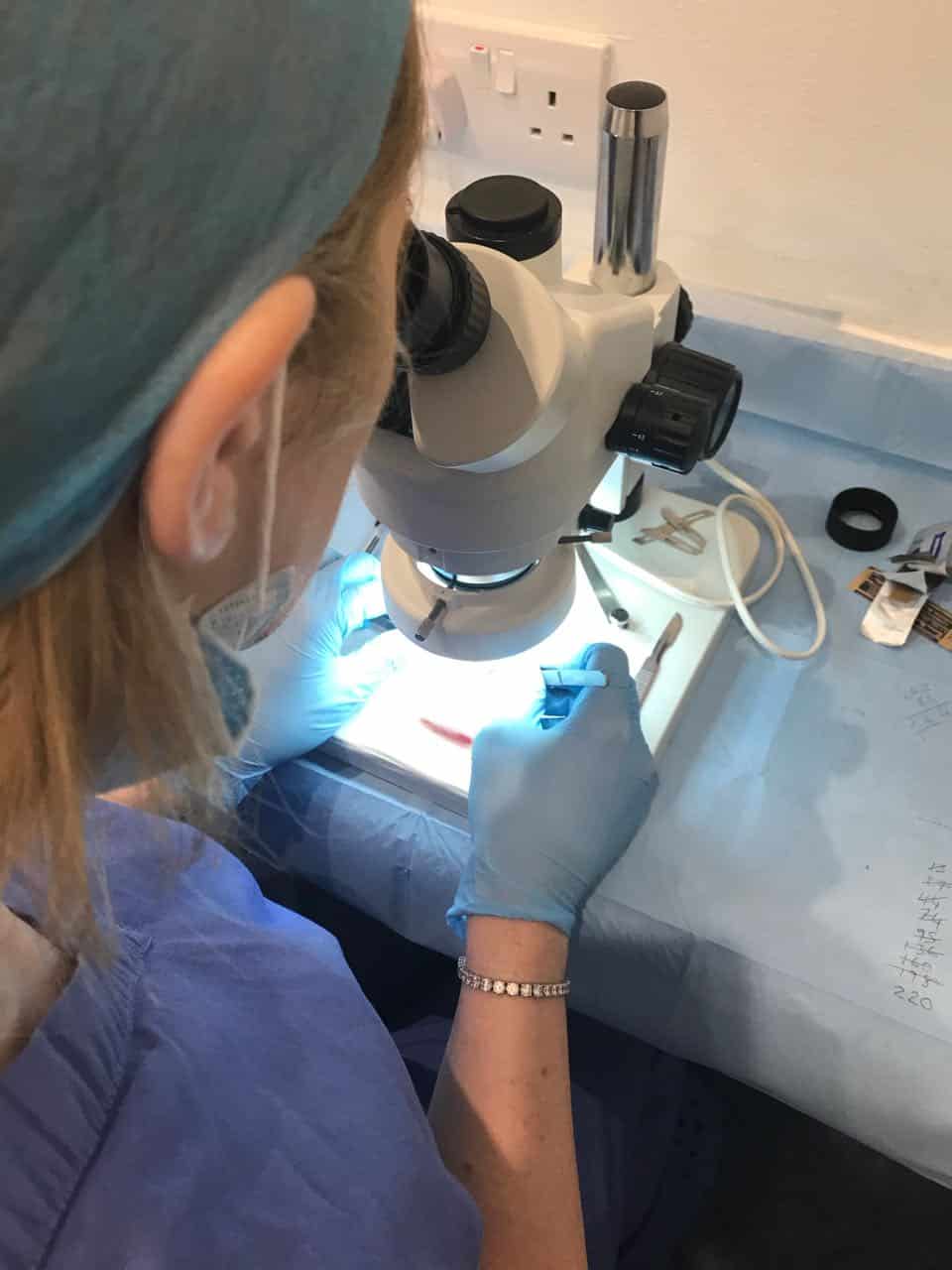 womens hair transplant tech at work